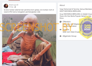 #CekFakta Korban Selamat dari Bom Gereja Kini di Rawat di RSJ Karena Pembengkakan Otak