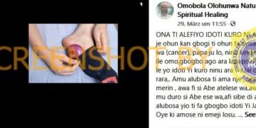 #CekFakta Meletakkan Bawang di Bawah Telapak Kaki Dapat Menyembuhkan Kanker dan Malaria