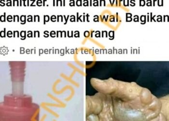 #CekFakta Mengandung Virus Baru, Merek Handsanitizer ‘Farah’ Dapat Sebabkan Tangan Melepuh