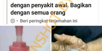 #CekFakta Mengandung Virus Baru, Merek Handsanitizer ‘Farah’ Dapat Sebabkan Tangan Melepuh