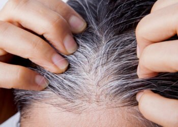 Bye-bye Uban! Tips Ampuh Mencegah Rambut Putih di Usia Muda