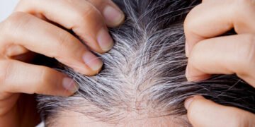 Bye-bye Uban! Tips Ampuh Mencegah Rambut Putih di Usia Muda